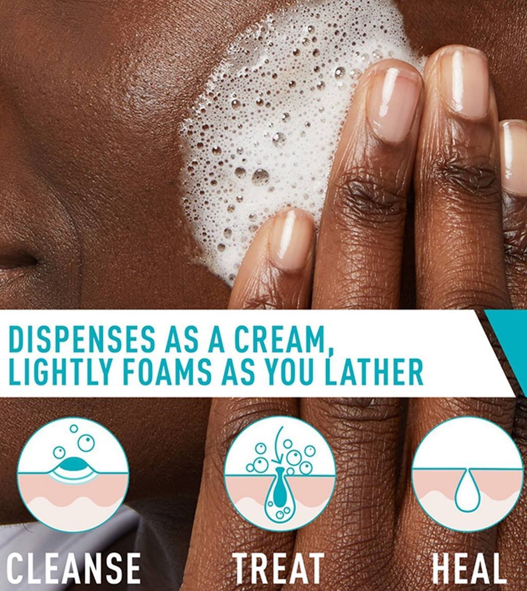 Acne Foaming Cream Cleanser - Image 2
